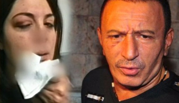 Mustafa Topaloğlu, eşi Derya Topaloğlu’nu hastanelik etti