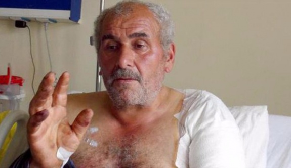 Ayı saldırısında yaralanan köylü: Ayının dilini tutup kurtuldum