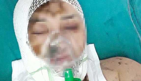 Önce cinsel saldırıda bulundu sonra kezzapla yaktı