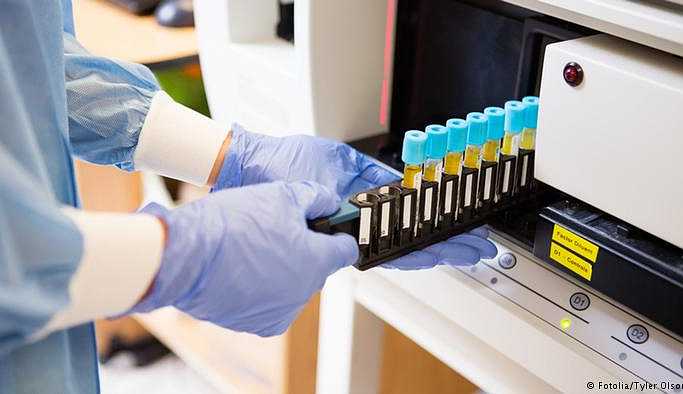 Sağlık Bakanlığı: Türkiye'de 15 binden fazla HIV taşıyıcısı var