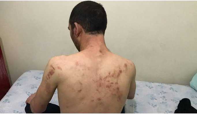 'Burası Kürdistan' dediği için emniyette işkence gördü