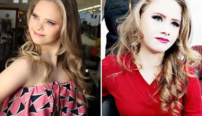 Down sendromlu 14 yaşındaki genç kız model oldu