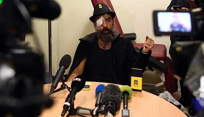 Plastik mermi yüzünden gözünü kaybeden Sarı Yelekler lideri Rodrigues: Davacı olacağım. Ne olursa olsun pasifist duruşumu koruyacağım