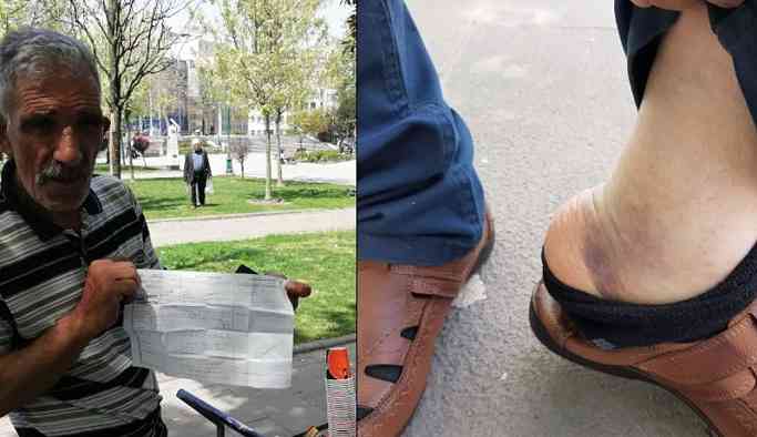 Polisten, dövülen seyyar satıcıya: Belki de kendin yaptın