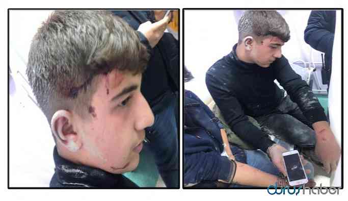 Ehliyetsiz çocuklara ateş açıldı, zırhlı araç çaptı, silah dipçikleri vuruldu