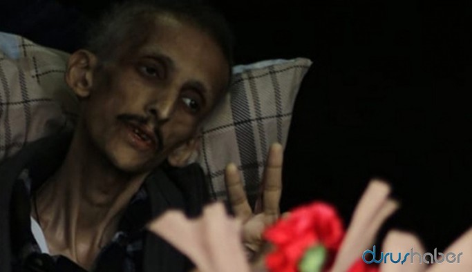 Ölüm orucunun 307. günü: Yaşamayı seviyorum, sadece türkü söylemek istiyorum