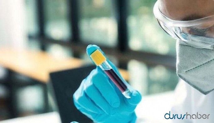 Sanayi ve Teknoloji Bakanı antikor testleri yapılacak illeri açıkladı