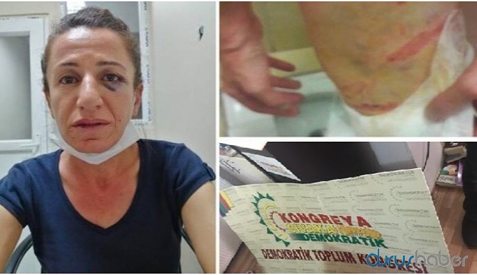 İşkenceye maruz bırakılan Rojbin Çetin'in gözaltı süresi uzatıldı