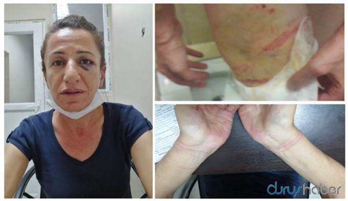 İnsan Haklarını İnceleme Komisyonu Başkanı iddia etti: Türkiye'de işkence yoktur