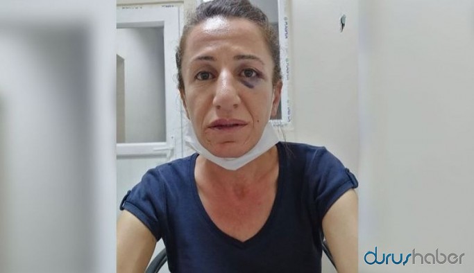 Köpekle işkence edilerek gözaltına alınan HDP yöneticisi Çetin adliyeye sevk edildi