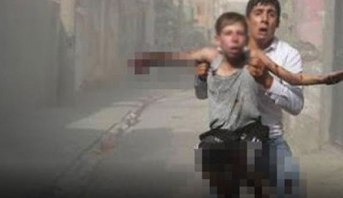 Cizre'deki patlamada uzuv kaybı yaşayan 13 yaşındaki Yusuf'a tazminat