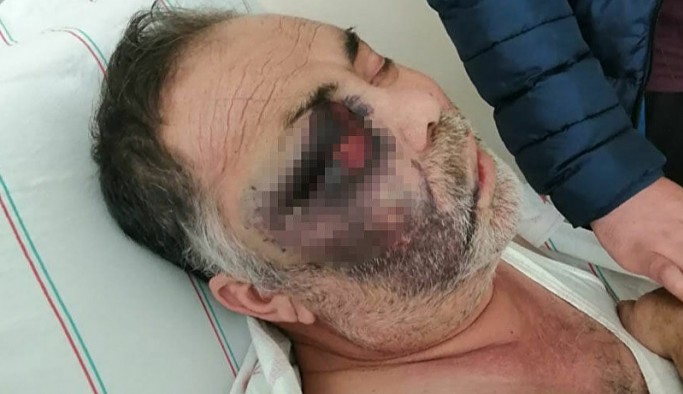 Park yeri kavgasında dövülen yüzde 90 engelli Mümün Kara yaşamını yitirdi