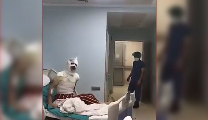 Trans kadının yüzüne kezzap atan saldırgan tutuklandı