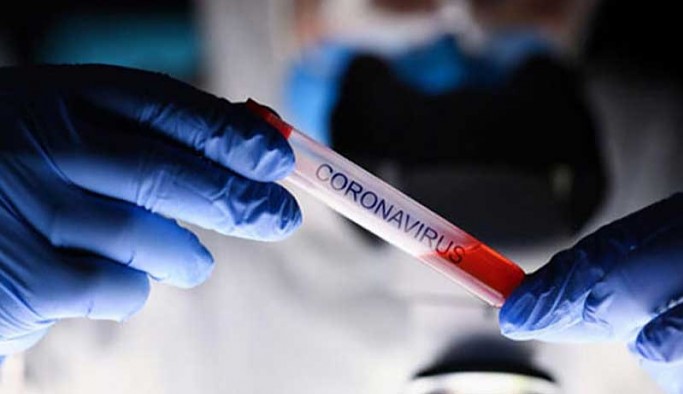 Vaka artışı durdurulamıyor: Bir günde 153 vefat, 29 bin 58 yeni vaka