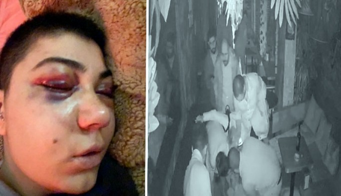 Taksim'de darp edilen kadının yüzü felç oldu: Normal hayata dönemiyorum