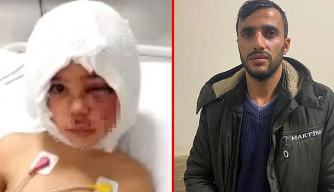 Pitbull saldırısında yaralanan 4 yaşındaki Asiye'nin babası işinden kovuldu