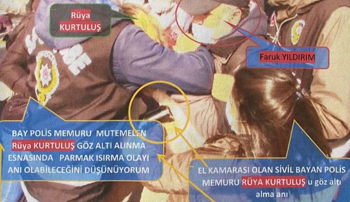 Polis ‘parmağımı ısırdı’ dedi, bilirkişi raporunu başka bir polis verdi, savcı 3 yıl hapis istedi
