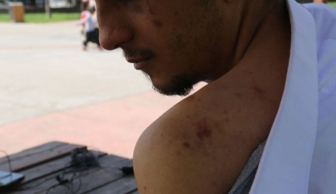 Taksim'de polis şiddetine uğrayan Kürt genç: 'Şikayet etme sicilin bozulur' dediler
