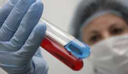 Yeni HIV aşısı ümit vadediyor