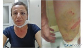 Hak örgütleri: Rojbin Çetin'e işkence yapanlara soruşturma açılsın
