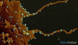 Korkutan araştırma: Koronavirüs enfekte ettiği hücrelerden kollar çıkarıp hücreden hücreye geçiyor