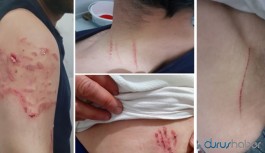 Diyarbakır'da polislerden köpekli işkence