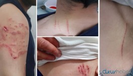 Diyarbakır Valiliği: Mukavemet etti, köpek de kendiliğinden refleks gösterdi