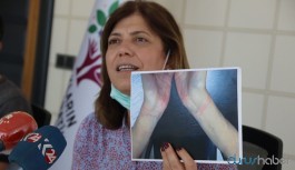HDP, Diyarbakır'daki işkencenin belgelerini paylaştı: Derhal açıklama bekliyoruz