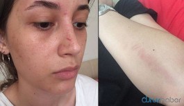 Şort giydiği için saldırıya uğradı, saldırgan serbest bırakıldı