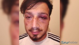 Yemek yemeğe gittiği mekanda polisler tarafından darp edildi