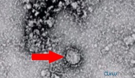 Çin’den bir virüs daha: 7 kişi hayatını kaybetti