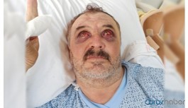 İşkence gören Şiban taburcu edildi: Hafıza kaybı sürüyor