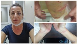 İnsan Haklarını İnceleme Komisyonu Başkanı iddia etti: Türkiye'de işkence yoktur